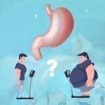 Who Can Have Gastric Surgery?