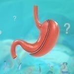 Things to Know About Gastric Surgery