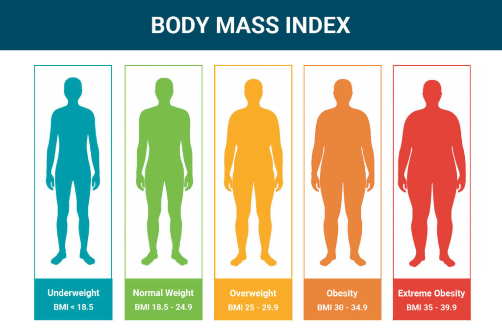 body mass index for gastric sleeve surgery in Turkey