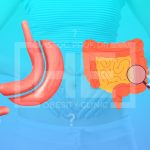 ¿Cómo afecta la digestión una gastrectomía en manga?