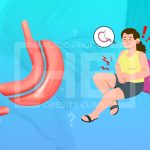 Is it normal to have diarrhea after gastric sleeve?