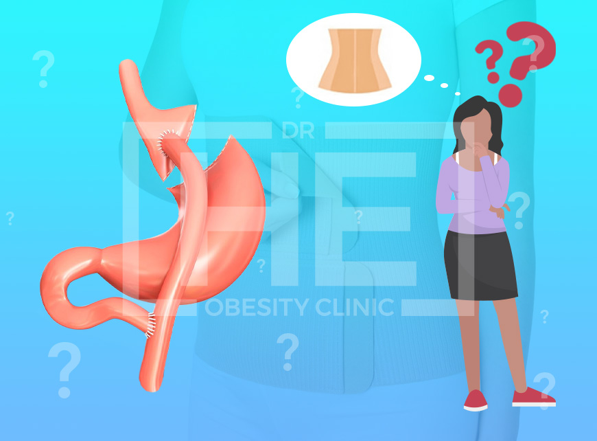 Should I Wear a Compression Garment After Gastric Sleeve Surgery?
