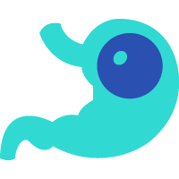 Balon Gastric